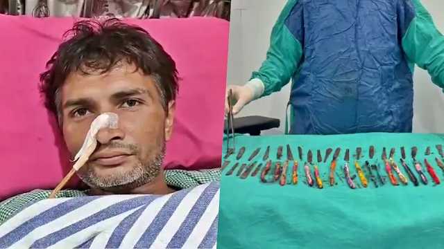 ରୋଗୀଙ୍କ ପେଟରୁ ବାହାରିଲା ୨୯ ଟି ଷ୍ଟିଲ୍ ଚାମଚ, ୧୯ଟି ଟୁଥବ୍ରସ୍ ଏବଂ ଦୁଇଟି କଲମ୍ , ଡ଼ାକ୍ତର ଆଶ୍ଚର୍ଯ୍ୟ